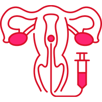 Ovulation Induction Treatment Noida
