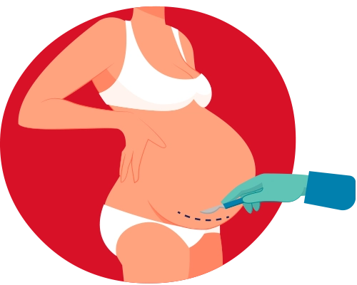c section delivery G. Noida